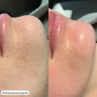 خدمات فیشال و پاکسازی پوست|خدمات آرایشگری و زیبایی|اهواز, زیتون کارگری|دیوار