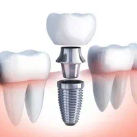 کلینیک تخصصی، دیجیتالی ایمپلنت و کاشت دندان حـامـی|خدمات آرایشگری و زیبایی|شیراز, ملاصدرا|دیوار