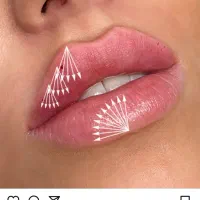 جشنواره آموزشی فیلر نخ بوتاکس زیر نظر دکتر...