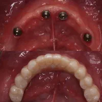 پیشنهاد ویژه اوردنچر با شرایط استثنایی و اقساطی