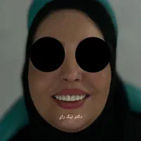 کامپوزیت زیبایی دندان|خدمات آرایشگری و زیبایی|صحنه, |دیوار