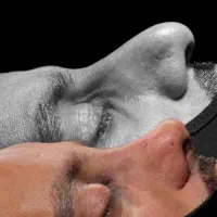 جشنواره جراحی و عمل بینی در کرج|خدمات آرایشگری و زیبایی|چهارباغ, |دیوار