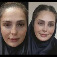قوی ترین روشن کننده و ضد لک جهانی بیوممتیک