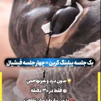 پاک کردن تتو با کیوسوییچ|خدمات آرایشگری و زیبایی|ارومیه, |دیوار