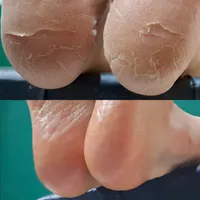 آموزش پدیکور آموزش پاکسازی پوست آموزش بافت