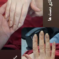 تا آخرهفته، مدل پاکسازی فقط با 198تومن|خدمات آرایشگری و زیبایی|رشت, جهاد|دیوار