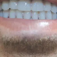 ساخت تخصصی دندان مصنوعی|خدمات آرایشگری و زیبایی|قم, آزادگان|دیوار