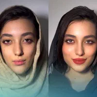 جشنواره پاییزه بوتاکس و فیلر و لیزر با تخفیف۳۰درصد|خدمات آرایشگری و زیبایی|اصفهان, فیض|دیوار