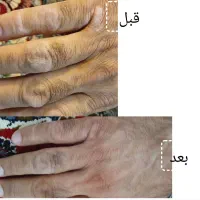 تونیک نانونقره وگان