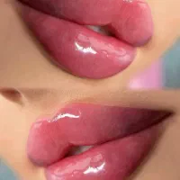 تزریق ژل و بوتاکس با متد جدید|خدمات آرایشگری و زیبایی|تهران, نازی‌آباد|دیوار