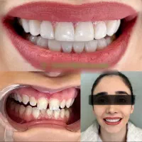 دندانپزشکی اقساط لمینت ایمپلنت و کلیه خدمات دندان|خدمات آرایشگری و زیبایی|مشهد, سجاد شهر|دیوار