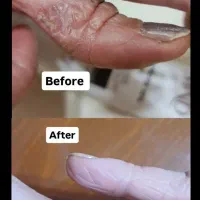 روتین پوستی|آرایشی، بهداشتی، درمانی|تهران, خواجه نصیر طوسی|دیوار