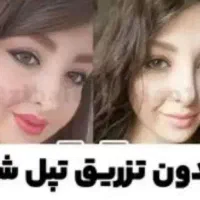 چاقی صورت|آرایشی، بهداشتی، درمانی|اهواز, کیان اباد|دیوار