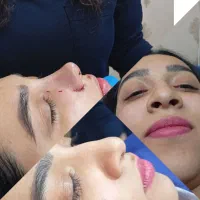 عمل زیبایی بینی با بهترین متد|خدمات آرایشگری و زیبایی|کرج, اتحاد|دیوار