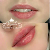 پزشک متخصص زیبایی آماده همکاری با مطبها،کلینیکها.|خدمات آرایشگری و زیبایی|تهران, الهیه|دیوار