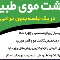 کاشت مو