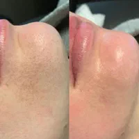 فیشال تخصصی و درمانی قم|خدمات آرایشگری و زیبایی|قم, زنبیل آباد|دیوار