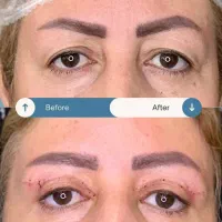 زیبایی لیفت بلفارو فرم بینی بوتاکس نخ ابروزاویه ژل|خدمات آرایشگری و زیبایی|اصفهان, خانه اصفهان|دیوار