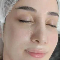 پوستت رومیکَنم وبهترشوبهت میدم مزوتراپی مو درمطب