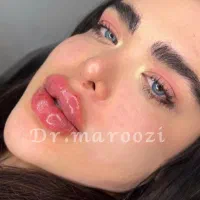 تزریق ژل لب بوتاکس لیفت ابرو کانتورینگ و آموزش|خدمات آرایشگری و زیبایی|تهران, پونک|دیوار