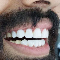 کامپوزیت زیبایی واحدی ۱،۶۰۰|خدمات آرایشگری و زیبایی|گرگان, |دیوار