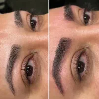 مدل میکروبلیدینگ