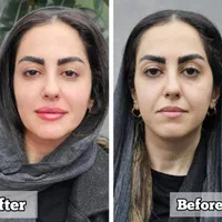 جشنواره مدلینگ ۱۰ سی سی امروز۳۳۰۰فیلر لب لیفت ابرو|خدمات آرایشگری و زیبایی|تهران, مرزداران|دیوار