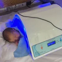 اجاره دستگاه زردی نوزاد(شهر قدس شهریار اندیشه
