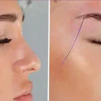 ژل لب وصورت ۸۰۰بوتاکس ۷۰۰ترمیم رایگان فول فیس ۵۸۰۰