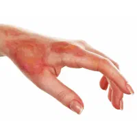 مشاوره رایگان تلفنی درمان زخم بسترو دیابتی18سال|خدمات آرایشگری و زیبایی|تهران, شهرک غرب|دیوار
