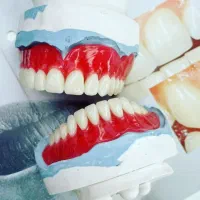 دندان مصنوعی سنندج