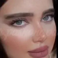 عمل بینی توسط متخصص با سابقه ۲۰ ساله