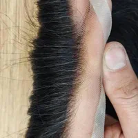 پروتز مو|خدمات آرایشگری و زیبایی|فردیس, طالقانی|دیوار