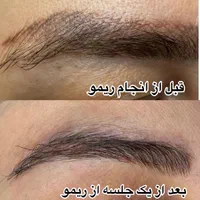 میکروبلیدینگ و ریموو تخصصی (ابرو،خط چشم ، خط لب)|خدمات آرایشگری و زیبایی|رشت, گلسار|دیوار