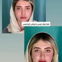 فیلر زل بوتاکس مزو بایو فیس لیفت پر کننده50/|خدمات آرایشگری و زیبایی|مشهد, هفت تیر (حافظ)|دیوار