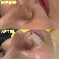 آموزش فیشال،مزو،پلاژن|خدمات آموزشی|تهران, تهرانسر شرقی|دیوار