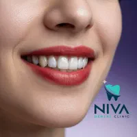 دندانپزشکی نیوا|خدمات آرایشگری و زیبایی|تهران, اختیاریه|دیوار