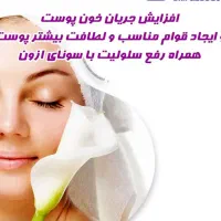 سونای اوزون