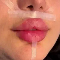 امروز29شهریور روز آخرشه (فقط850)درمطب/پزشک تضمینی