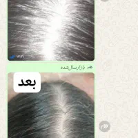 روغن تقویت و رشد مجدد مو|خوردنی و آشامیدنی|تهران, نارمک جنوبی|دیوار