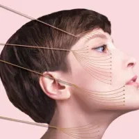 جشنواره تزریق فیلرو بوتاکس و نخ لیفت و PRP و هایفو