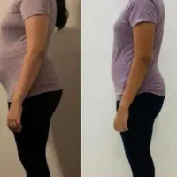 لاغری و رفع سلولیت تضمینی