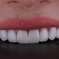 تمامی خدمات دندانپزشکی و کامپوزیت و فیسینگ|خدمات آرایشگری و زیبایی|شیراز, فرهنگ شهر|دیوار