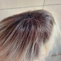 پوستیژ|آرایشی، بهداشتی، درمانی|تهران, شهرک فردوس (حسینی)|دیوار