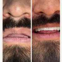 دندانپزشکی دکتر مسعود حسینی(بیمه دانا، کارآفرین)