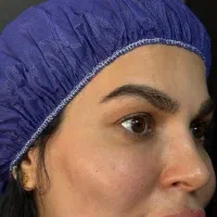 انواع جراحی های زیبایی صورت و بدن|خدمات آرایشگری و زیبایی|رشت, آتشگاه|دیوار