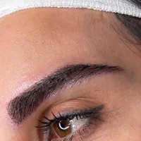 کاشت ابرو به روش جراحی با کمترین هزینه