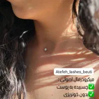 تخفیف ویژه فیلر هر سی سی ۶۰۰هزارتومان اصلی تضمینی|خدمات آرایشگری و زیبایی|فولادشهر, B2|دیوار