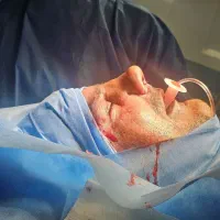 جراحی بینی توسط دکتر متخصص امیر اسدالله پور|پزشکی|قائمشهر, |دیوار
