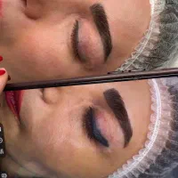 ریمو تتو با تضمین سلامت پوست